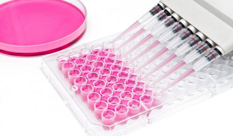 COVID 19 Impact on In Vitro Diagnostics Market worth $77.9 billion by 2025